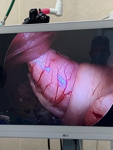 Close-up view of a monitor displaying a minimally invasive laparoscopic veterinary surgery in Fairlawn